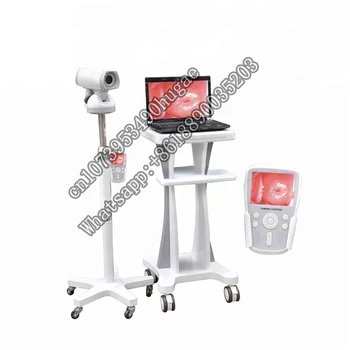 LH9800A Гореща разпродажба на Цифрова електронна видео колпоскопия за гинекология/Преносими гинекологическая машина за жени