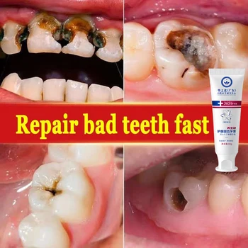 Бързо лечение на кариес, отстраняване на зъбна плака, пожълтяване, намаляване на броя на многото бактерии в устната кухина, лош дъх в устата, язви в устата