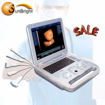 Цена по цена на производителя, 3D апарат за УЛТРАЗВУК бременност на базата на преносими КОМПЮТРИ SUN-800D